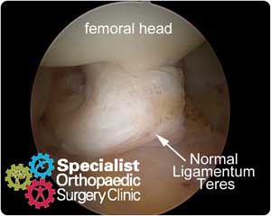 ar-ligteres-normal-300