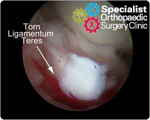 ar-ligteres-torn01-300